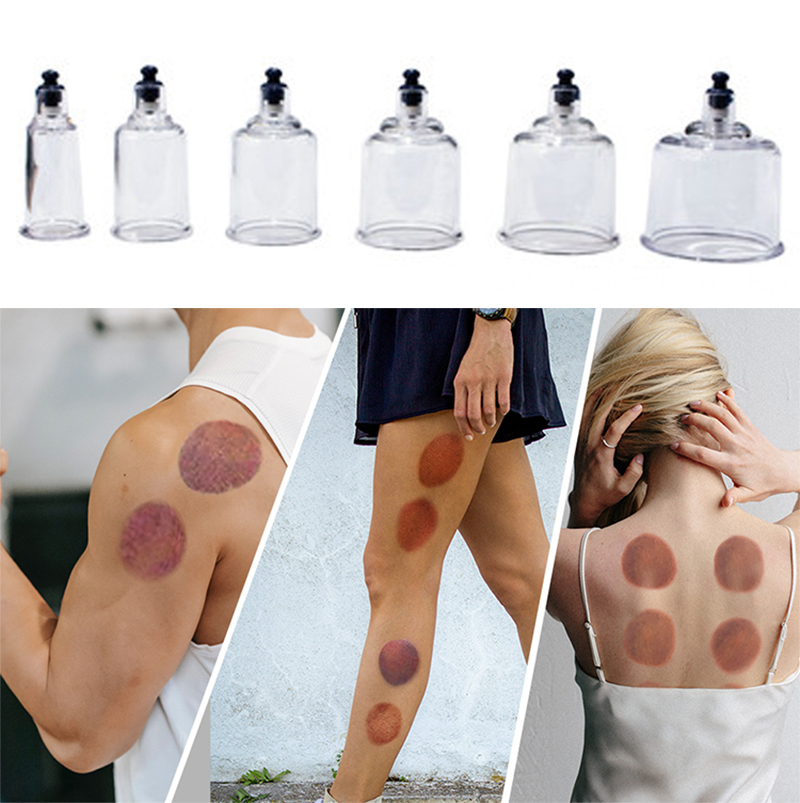 17cans Cupping Therapy Set Ven - Cupping Therapy Set review and price